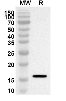 EGF Rabbit Polyclonal Antibody