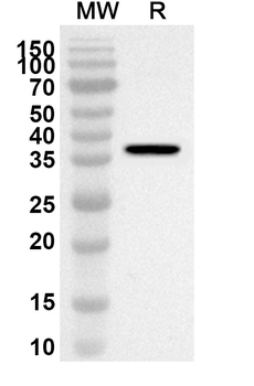 LDHA Rabbit Polyclonal Antibody