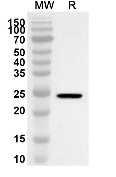SOCS2 Rabbit Polyclonal Antibody