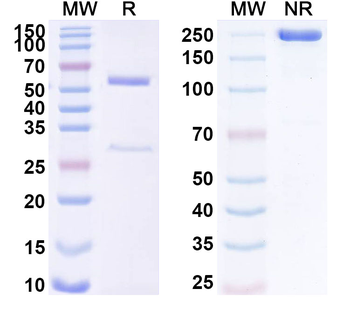 IgE/IGHE Mouse Monoclonal Antibody