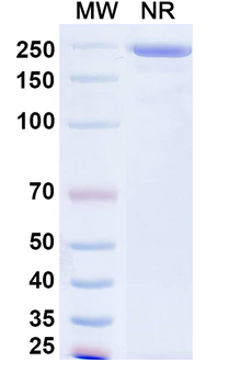 SFTSV glycoprotein Gn Human Monoclonal Antibody
