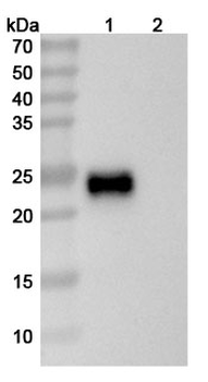 TNFSF15/TL1A Human Monoclonal Antibody