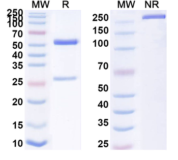 REBOV/SEBOV/TAFV/ZEBOV NP/Nucleoprotein Human Monoclonal Antibody