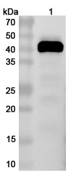 Chicken Gal d 2/OVA/Ovalbumin Rabbit Polyclonal Antibody