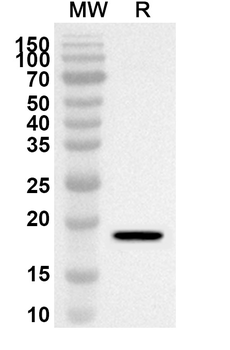 Neisseria meningitidis NadA Rabbit Polyclonal Antibody
