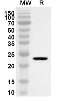 SYNGAP1 Rabbit Polyclonal Antibody