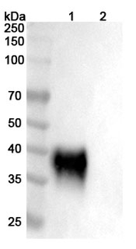 Recombinant Human CD48 Protein, C-His