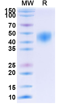 Recombinant Human CD48 Protein, C-His