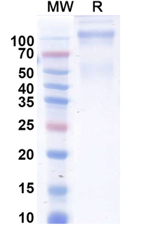 Recombinant Human MET/c-Met/HGFR Protein, C-His