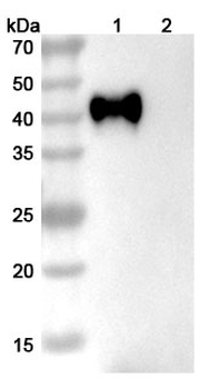 Recombinant Human CD38 Protein, C-His