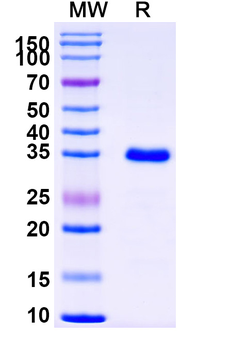 Recombinant Human DNMT3A Protein, N-His