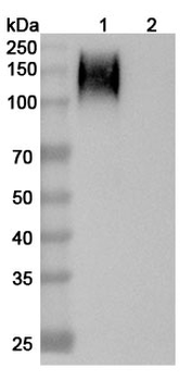 Recombinant Human CD66e/CEA/CEACAM5 Protein, C-His