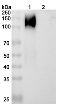 Recombinant Human CD66e/CEA/CEACAM5 Protein, C-His