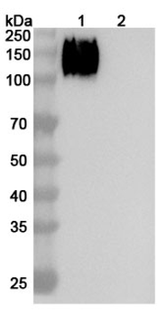Recombinant Human CD66e/CEA/CEACAM5 Protein, C-His