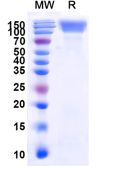 Recombinant Human CD66e/CEA/CEACAM5 Protein, C-His