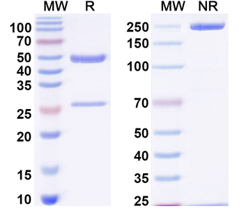 Ganglioside GM3/NeuGcGM3 Mouse Monoclonal Antibody