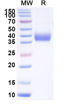 Recombinant SARS-CoV-2 RBD (JN.1) Protein, C-His