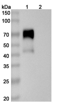 CD126/IL6R/IL-6RA Mouse Monoclonal Antibody