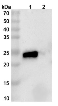 TNFSF15/TL1A & TNFa/TNF-alpha Human Monoclonal Antibody