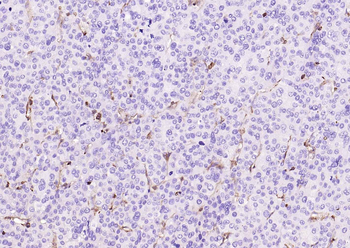 CD206 Recombinant Rabbit Monoclonal Antibody