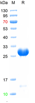 Recombinant mouse CTRC protein,C-His