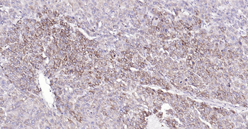 Human COX4I1(Mitochondrial Loading Control) Ready-To-Use IHC Kit