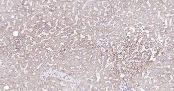 Human COX4I1(Mitochondrial Loading Control) Ready-To-Use IHC Kit