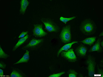 GSK-3 Beta Rabbit Polyclonal Antibody