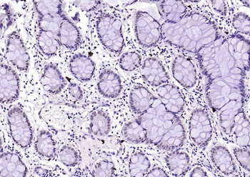 Phospho-GSK-3 Beta (Ser9) Mouse Monoclonal Antibody