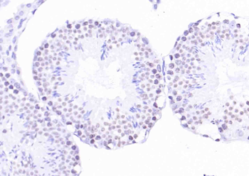 H2AX Rabbit Polyclonal Antibody