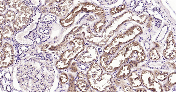 Human CD26/DPP4 Ready-To-Use IHC Kit