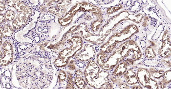 CD26/DPP4 Ready-To-Use IHC Kit