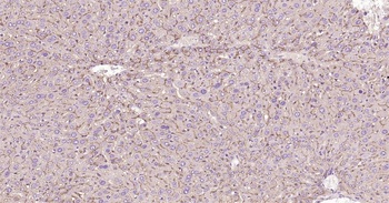CD26/DPP4 Ready-To-Use IHC Kit