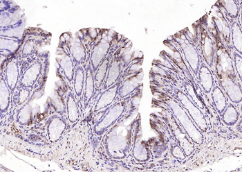 GAPDH Rabbit Polyclonal Antibody (Loading Control)
