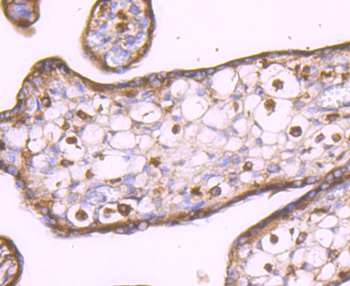LXR alpha Recombinant Rabbit Monoclonal Antibody