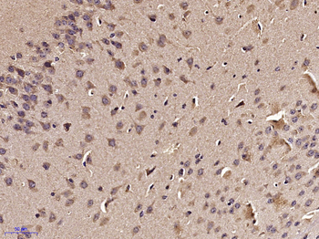 Phospho-TAK1 (Thr187) Rabbit Polyclonal Antibody