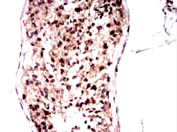 LIPE Antibody