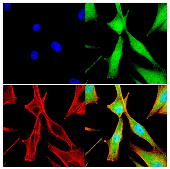 SOCS1 Antibody