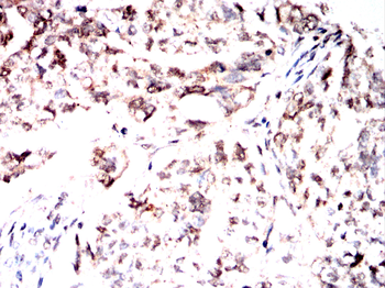 SOCS1 Antibody