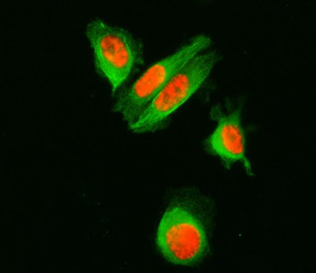 SF3A1 Rabbit Polyclonal Antibody