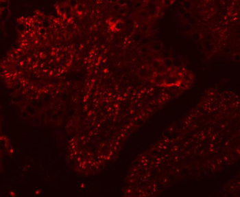 SF3A1 Rabbit Polyclonal Antibody
