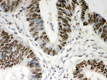 Goat Rabbit IgG (H+L) Secondary Antibody (Biotin)