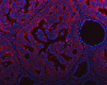 NDUFAF4 Rabbit Polyclonal Antibody