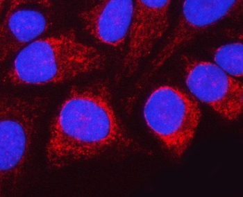 NDUFAF4 Rabbit Polyclonal Antibody