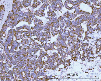 NDUFAF4 Rabbit Polyclonal Antibody