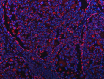 GRIM19/NDUFA13 Rabbit Polyclonal Antibody