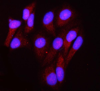 GRIM19/NDUFA13 Rabbit Polyclonal Antibody