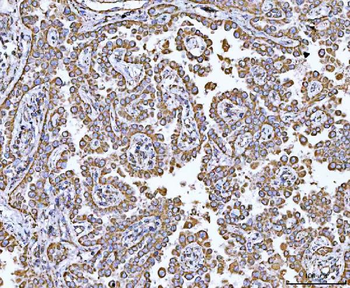 GRIM19/NDUFA13 Rabbit Polyclonal Antibody