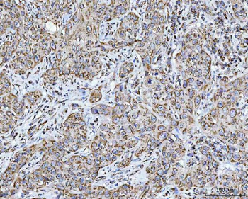 GRIM19/NDUFA13 Rabbit Polyclonal Antibody