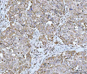 GRIM19/NDUFA13 Rabbit Polyclonal Antibody